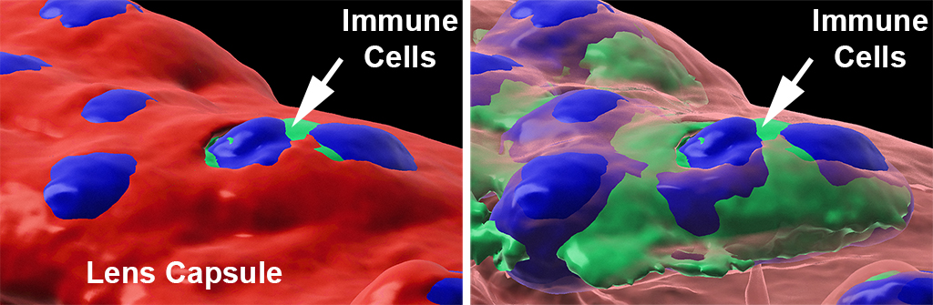 Newswise: Reimagining Immunity in the Eye