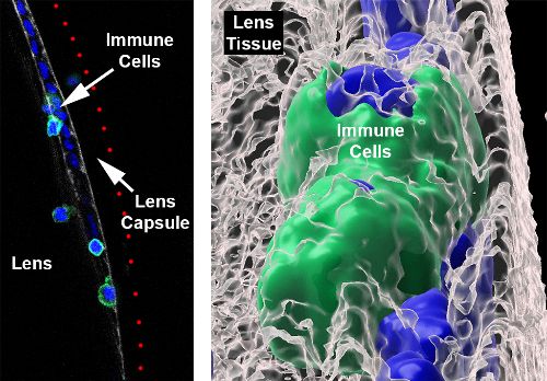 Newswise: Reimagining Immunity in the Eye